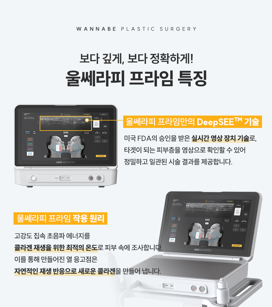 울쎄라피 프라임만의 DeepSEE 기술 - 미국 FDA의 승인을 받은 실시간 영상 장치 기술, 울쎄라피 프라임 작용 원리 - 콜라겐 재생을 위한 최적의 온도, 자연적인 재생 반응으로 새로운 콜라겐 생성.