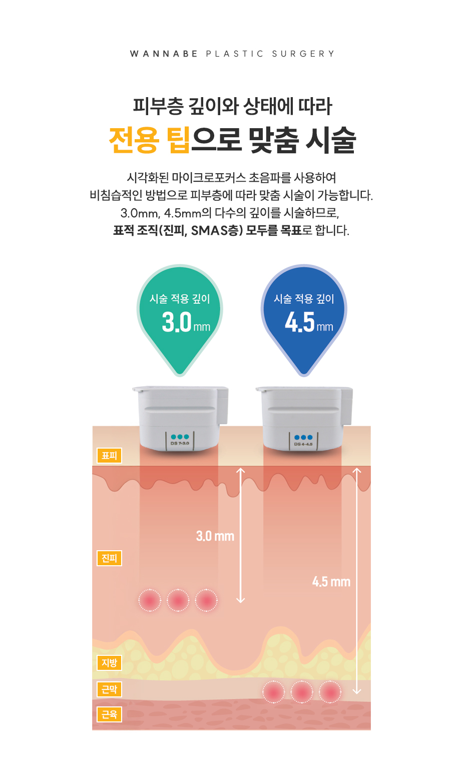 피부층 깊이와 상태에 따라 전용 팁으로 맞춤 시술
